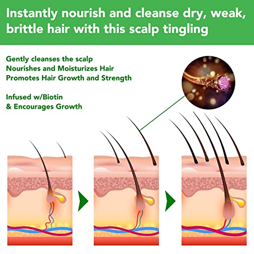 Rosemary Shampoo, 300ml Rosemary Shampoo for Cleanse Hair, Helps Improve Hair Growth, Moisturize & Soften Hair, Hair Care Shampoo for Hair Loss,