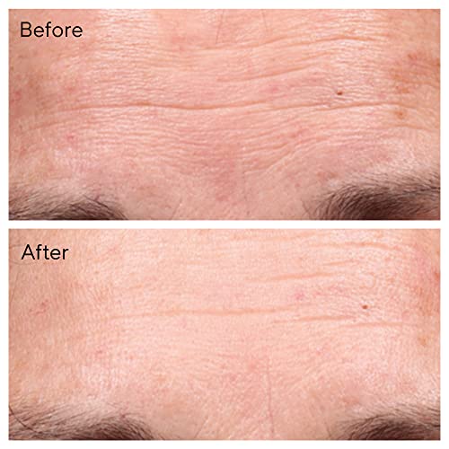 Murad Resurgence Retinol Youth Renewal Serum - Anti-Aging Serum for Lines and Wrinkles 30 ml