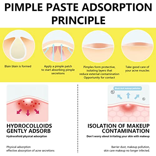 Hydrocolloid Acne Patch, Large Pimple Patch Spot Control Cover, Acne Patch for Covering Large Breakouts, Spot Patch, Pimple Stickers for Body, Ch