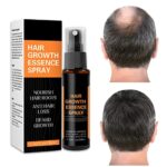 Hair Regrowth Spray,Hair Growth Serum,Hair Regrowth Treatment for Men & Women Hair Rapid Growth Dens,Anti Hair Loss,Natural Ingredients Hair Regr
