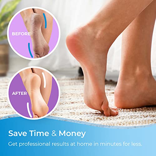 Compatible with Scholl Express Pedi - Refill Extra Coarse Replacement Rollers (Pack of 4)