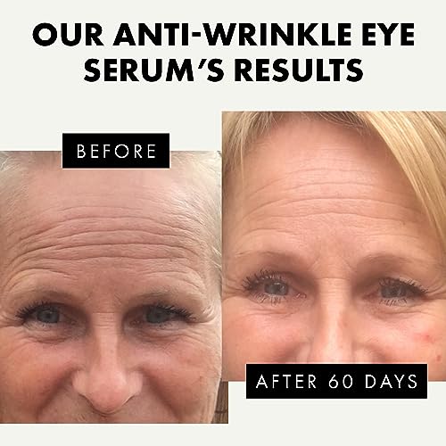 Hyaluronic Acid Under Eye Cream for Dark Circles and Puffiness - Anti Aging Eye Cream with Peptides, Caffeine, Collagen, Vitamin C+E, Under Eye S