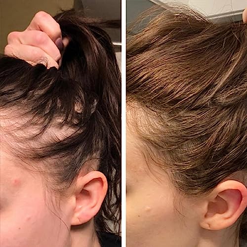 Rosemary Oil For Hair Growth,Hair Growth Oil,Rosemary Essential Oil,Rozmarin oil for hair Growth,Wild Growth Hair Oil,Natural Rosemary Water For