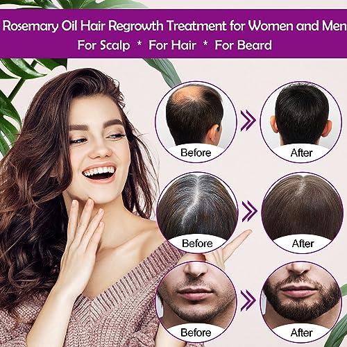 Rosemary Oil Serum for Hair Growth Diluted W/Scalp Massager Hair Growth Oil Serum with Rosemary Oil Biotin Castor Oil Argan Oil Caffeine Keratin