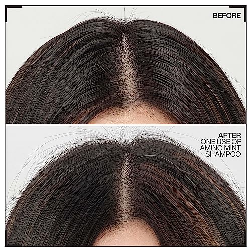 REDKEN Scalp Relief Shampoo, Soothing Formula, Cleanses and Purifies Greasy Hair and Sensitised Lengths, Refreshes the Roots and Adds No Weight,