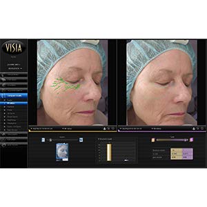 My Perfect Eyes - The Perfect Cosmetic Company Instant Anti-Aging Anti-wrinkles Eye Cream - Reduces Dark Circles Fine Lines and Puffiness Under E