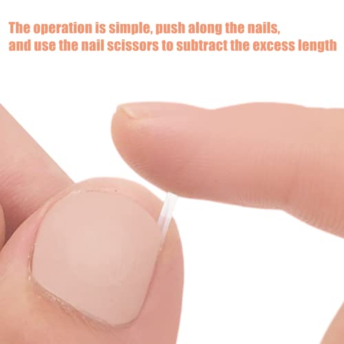 Ingrown Toenail Correction Treatment Kit with 12 Pcs Ingrown Toenail Correction Pad Recover Clips Ingrown Toenail Corrector Straightener Strips f