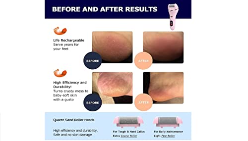 Latest Wizcom Electric Foot File Callus Remover for Dry Dead Skin Waterproof and Rechargeable Professional 10 in 1 Care for Foot (White)