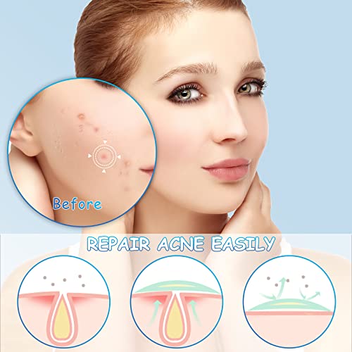 252pcs Day and Night Spot Patches, Translucent Hydrocolloid Spot Stickers for Facial Pimple, Effective Reduce Blemishes and Spots Cover Fit for A