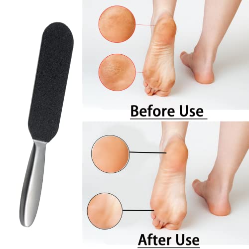 Foot Files for Hard Skin,Double-Sided Foot Scraper Hard Skin Remover,Foot Scrubber with 10PCS Free Refill Grits Double-Sided Replacement Pads,Exf