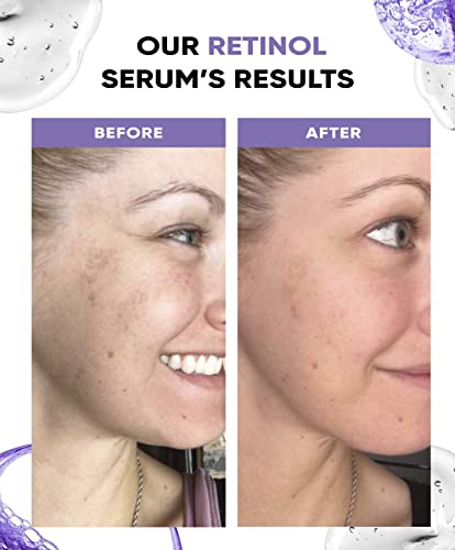 Perfect Look London Retinol Serum for face with Hyaluronic Acid, Advanced Anti Aging and Wrinkle High Strength Formula with Vitamin A/Retinoid Fa