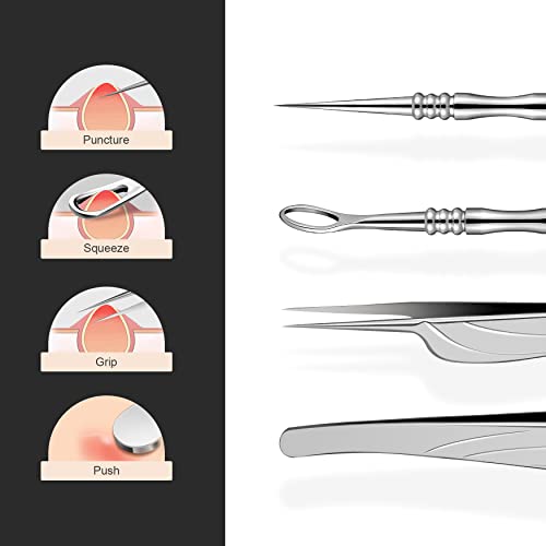 BEZOX Blackhead Remover Tools ALL Stainless Steel – Set of Blackhead Tweezers and Ance Needle with Comedone Extractor, High Temperature Disinfect