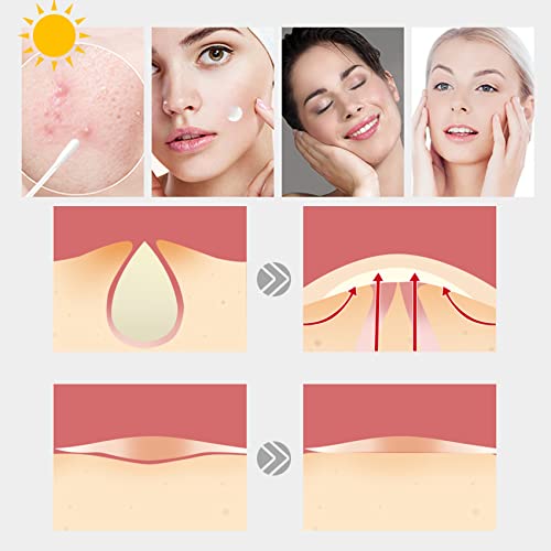LacyMC 60 Patches Acne Patches,Size 8mm & 12mm,Hydrocolloid Dressing Cover,Dots for Spots Pimple Patches