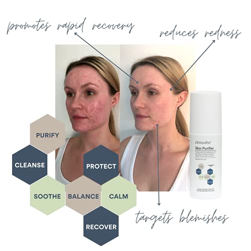 Clinisoothe+ Skin Purifier 250ml - Spot and Acne Treatment For Face and Body, Prevent Breakouts And Promote Rapid Recovery With Hypochlorous Tech
