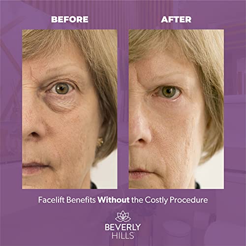 BEVERLY HILLS V-Lift Instant Eye Lift and Tuck Bee Venom Serum for Treating Puffy Eyes, Dark Circles, and Wrinkles