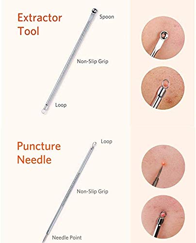 Blackhead Remover Tool Kit Comedone Extractor, Karpo 5 in1 Blackhead Cleaner Tweezers Kit, Curved Professional Stainless Pimple Acne Blemish Remo