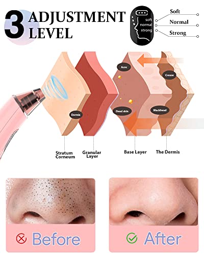 Pore Vacuum, Blackhead Remover Vacuum for Face Acne Comedone Whitehead Extractor Kit with 3 Suction Power & 4 Probes and LED Display Electric Bla