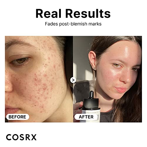 COSRX Niacinamide 15% Face Serum, Minimizing Pores & Sebums, Blemish Treatments for Discoloration, Dark Spots, Enlarged Pores, Anti-aging, 0.67 f