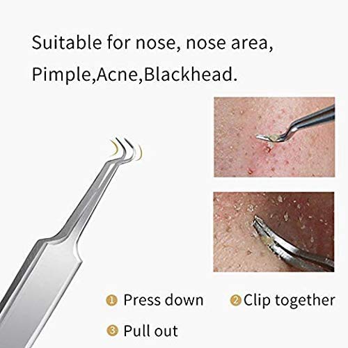Blackhead Remover Tool Kit Comedone Extractor, Karpo 5 in1 Blackhead Cleaner Tweezers Kit, Curved Professional Stainless Pimple Acne Blemish Remo