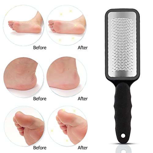 Foot Rasp Hard Skin Remover, Dead Skin Remover for Feet, Pedicure Foot File Make Foot Beauty Extra Smooth, Foot Scrub Foot Exfoliator for Corn Re