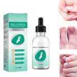 Kerassentials Toenail Fungus Treatment Oil, Best Repair Solution for Fingernails and Toenails, Fix & Renew Damage Fungal Nail, Broken, Cracked &