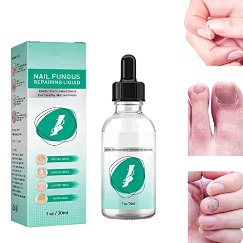 Kerassentials Toenail Fungus Treatment Oil, Best Repair Solution for Fingernails and Toenails, Fix & Renew Damage Fungal Nail, Broken, Cracked &