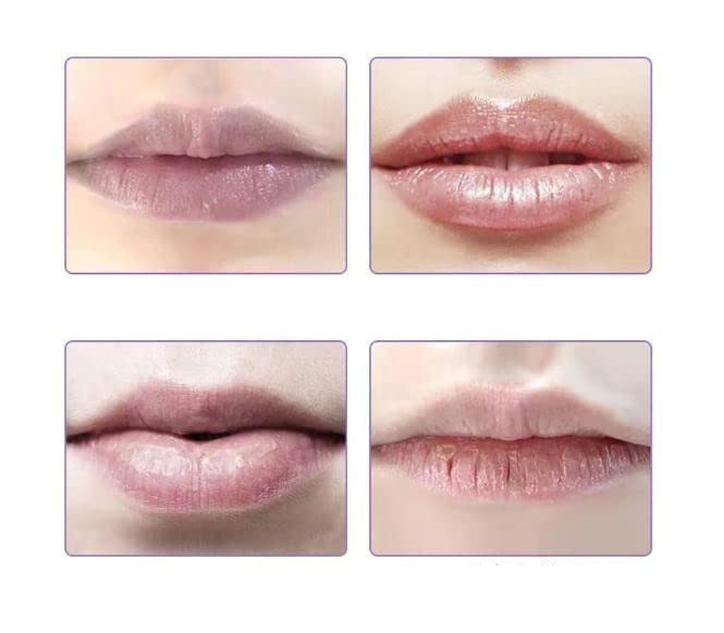 City Lips Lip Plumper | Clear Honey Lip Plumper Gloss | Essence Extreme Shine Lip Gloss Oil | Lip Gloss Base Filler Locks In Moisture For Lip Car