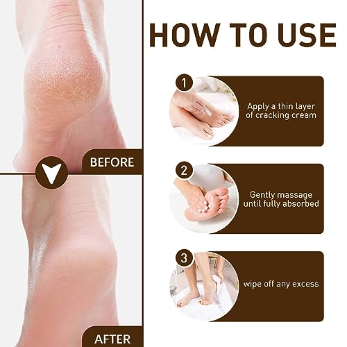 Cracked Skin Repair Cream,Foot Repair Cream,Anti Crack Heel Balm,Quickly Cracked Heel Repair Cream,Feet & Lip & Leg,Foot Cream For Cracked Heels