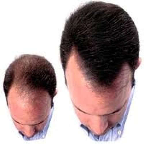 Beaver KERATIN Hair Building Fibres Hair Loss Concealer 28g Dark Brown (Beaver Fibres)