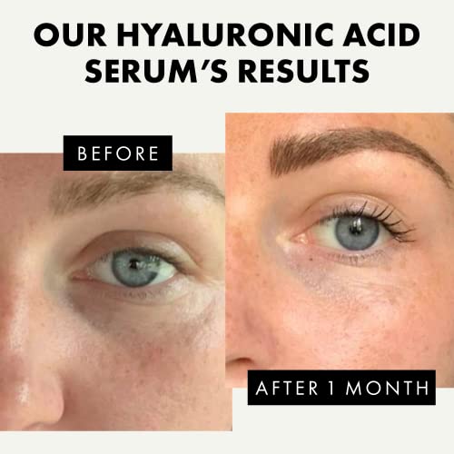 Pure Hyaluronic Acid Serum for Face with 2% HA & 10 Antioxidants - High Strength Hyaluronic Acid Serum for Skin Care - Hydrating, Firming, Plumpi