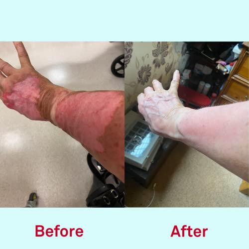 Nursem CARING SKIN FIX β 50ml | Intensive hand treatment & intensive restoring natural barrier cream for hard-working hands, suitable for sensiti