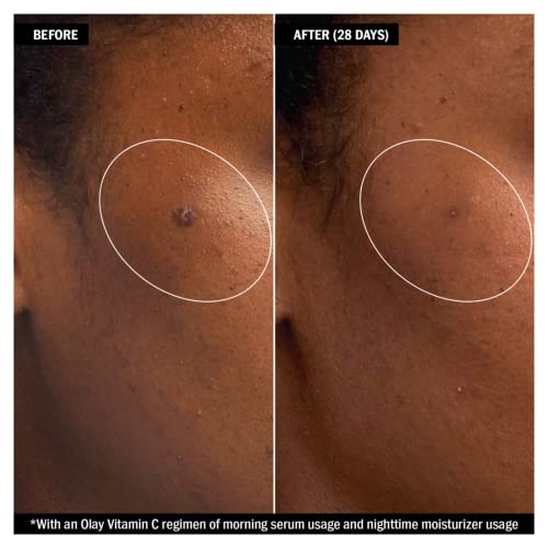 Olay Vitamin C + AHA24 Day Gel Serum With Vitamin C, AHA & Niacinamide For Bright And Even Skin Tone, 40ml