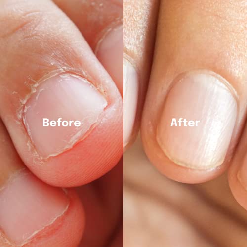 Healr Bitter Nail Polish - Ideal Stop Biting Nails Polish: Nail Biting Prevention for Adults & Kids, Also A Thumb Sucking Prevention for Children