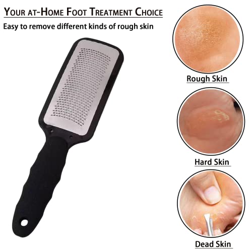 Hard Skin Remover Foot Files, Foot Scraper Hard Skin Remover, Stainless Steel Foot Callus Remover Foot Grater for Dead Skin, Hard Skin, Tough Ski