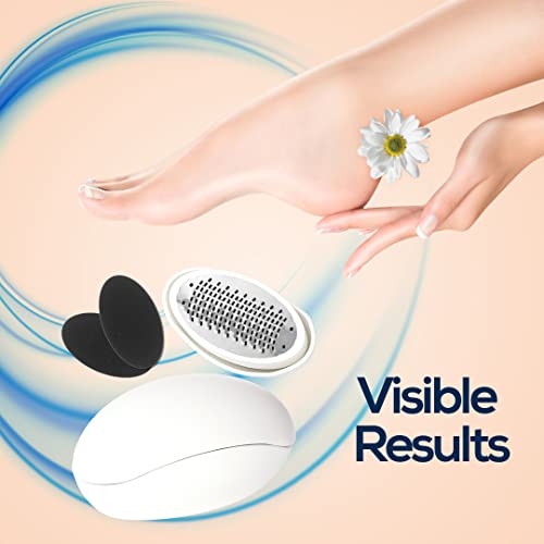 MUJGAN Egg Shaped Classic Callus Remover, Safely and Painlessly Remove Tough Calluses & Dry Skin to Reveal Smooth Soft Feet, 135 Precision Micro-