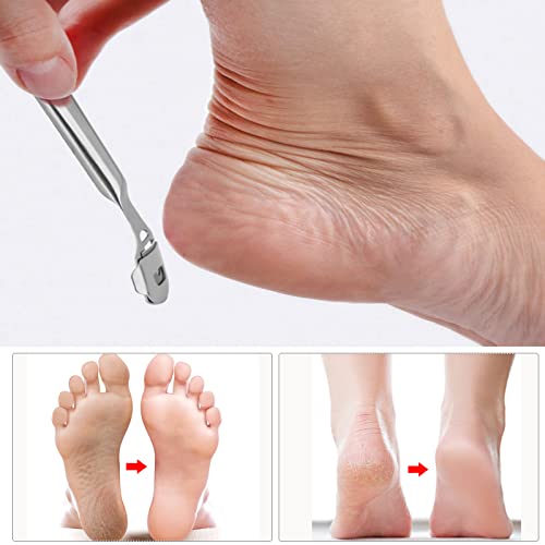 Foot Files Set Callus Shaver - Pedicure Foot Scraper Dead Hard Skin Remover Heel Corn Cracked Skin Removal Foot Rasp Kit - Stainless Steel Foot C