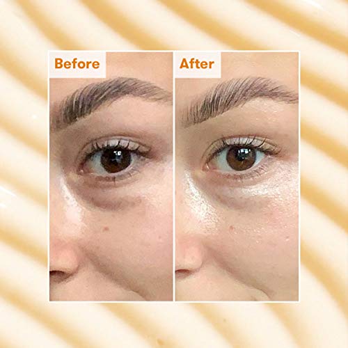 REN Clean Skincare Brightening Dark Circle Eye Cream | Hydrates & Proven to Reduce Dark Spots in 7 Days | Revives & Firms Tired Under Eyes by Eve