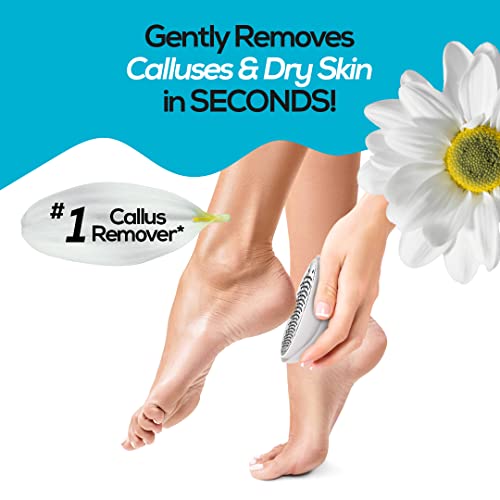 MUJGAN Egg Shaped Classic Callus Remover, Safely and Painlessly Remove Tough Calluses & Dry Skin to Reveal Smooth Soft Feet, 135 Precision Micro-