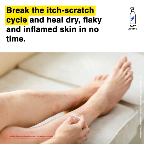 Healpsorin Emollient Balm: Itch Relief Cream Helps Repair Skin Barrier and Treat Conditions Such as Eczema, Psoriasis & Dermatitis - Rash Cream C