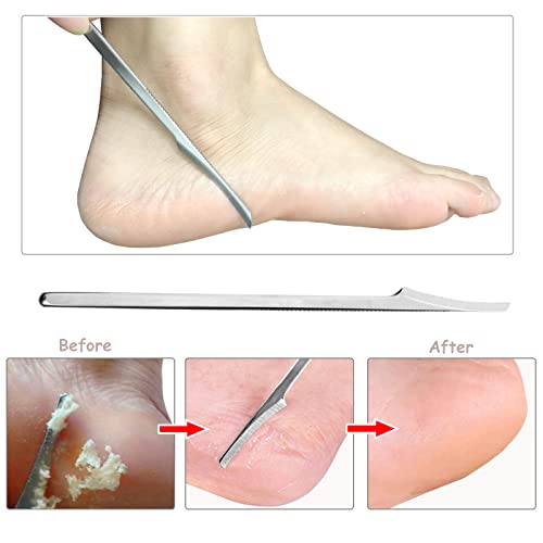 Foot Files Set Callus Shaver - Pedicure Foot Scraper Dead Hard Skin Remover Heel Corn Cracked Skin Removal Foot Rasp Kit - Stainless Steel Foot C