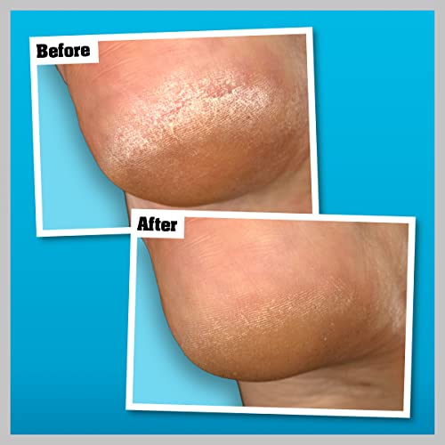 O’Keeffe’s Healthy Feet Overnight, 2 x 80ml Tubes – Intensive Foot Cream for Extremely Dry, Cracked Feet | Visible Results in 1 Night