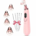 Blackhead Remover Vacuum Electric Blackhead Remover Pore Vacuum Pore Cleaner with 3 Levels and 4 Suction Heads - Face Pore Vacuum Blackhead Remov