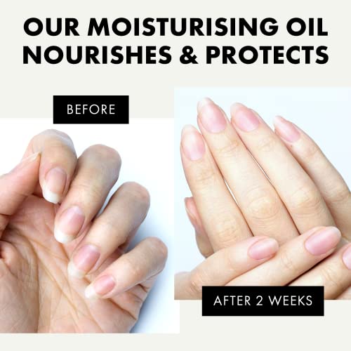 Advanced Cuticle Oil - 3X More Hydrating with Vitamin E for Brittle/Damaged/Dry Nails & Cuticles - Water-Free - Palm Oil - Free 100% Vegan/Dermat