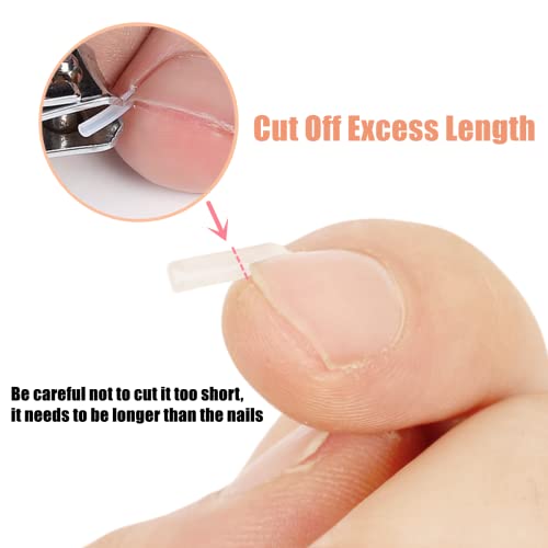 Ingrown Toenail Correction Treatment Kit with 12 Pcs Ingrown Toenail Correction Pad Recover Clips Ingrown Toenail Corrector Straightener Strips f