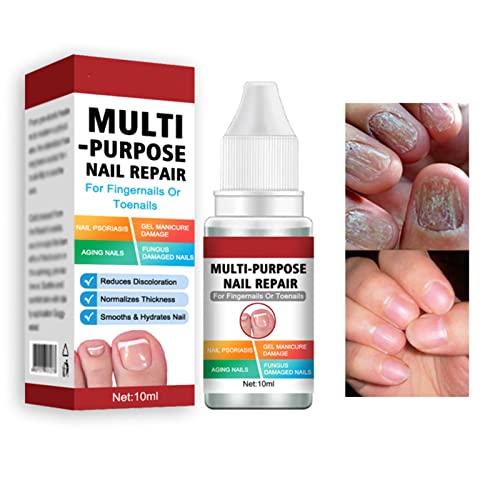 Fungal Nail Treatment for Toenails Extra Strong,Nail Fungus Treatment for Toenail,Toenail Fungus Treatment,Nail Repair for Fingernails Toenails,S
