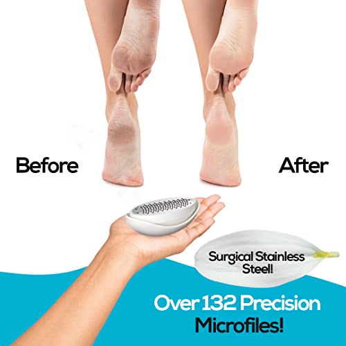 MUJGAN Egg Shaped Classic Callus Remover, Safely and Painlessly Remove Tough Calluses & Dry Skin to Reveal Smooth Soft Feet, 135 Precision Micro-