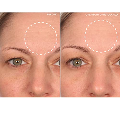 SiO Beauty Forehead Anti-Wrinkle Patch - Rapid Overnight Reusable Silicone Patch To Reduce Furrows, Expression Lines, And Creases BrowLift