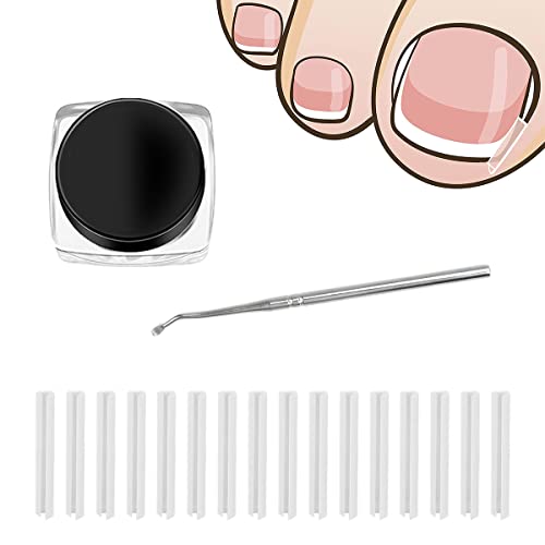 Ingrown Toenail Correction Patch Ingrown Toenail Sticker Patch 50PCS Nail Correction Sticker with 4PCS Nail Correction Tool,Glue-Free Toenail Cor