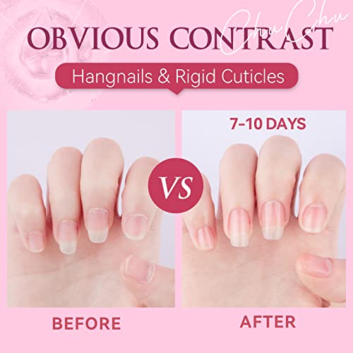 CHUCHU Cuticle Oil for Nails, Jojoba Nail Cuticle Oil Contain Vitamin B & E, Moisturizes Cuticle and Nail's Skin, Strengthens Nails, Prevents Han