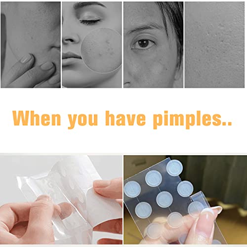 LacyMC 60 Patches Acne Patches,Size 8mm & 12mm,Hydrocolloid Dressing Cover,Dots for Spots Pimple Patches